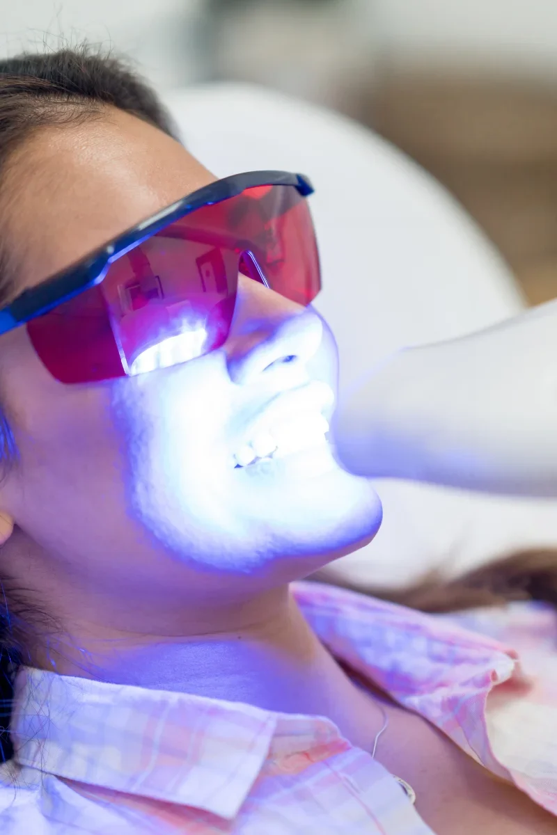 The benefits of Teeth Whitening