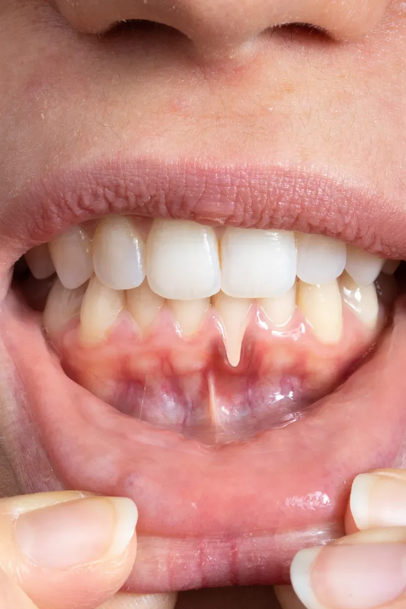 Benefits of Soft Tissue Management