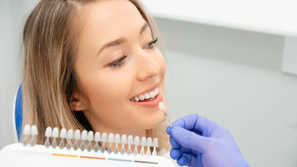 Dental Veneers