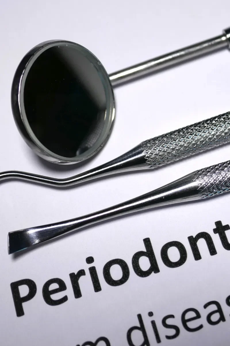 Periodontal Care (Gum Health)